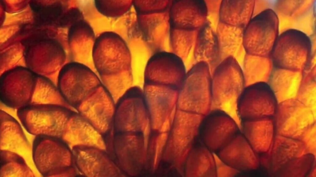 Puccinia striiformis f. sp. tritici