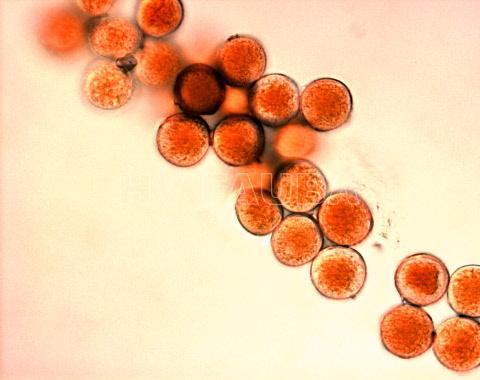 Puccinia triticina